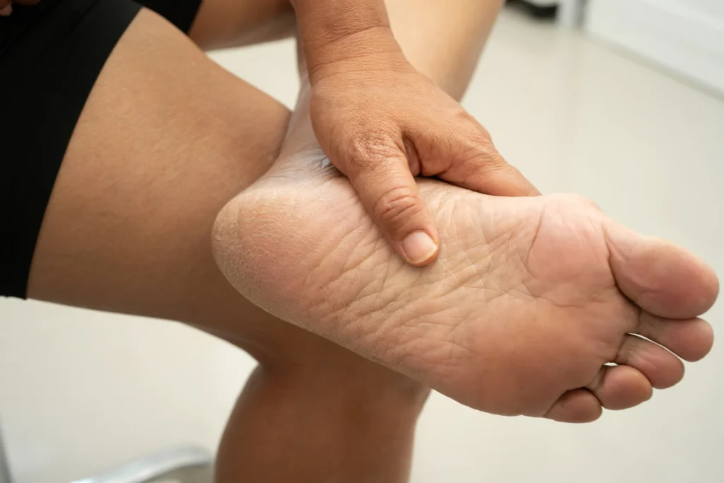 close up of foot with dry skin on heel 2026 03 23 23 04 35 utc