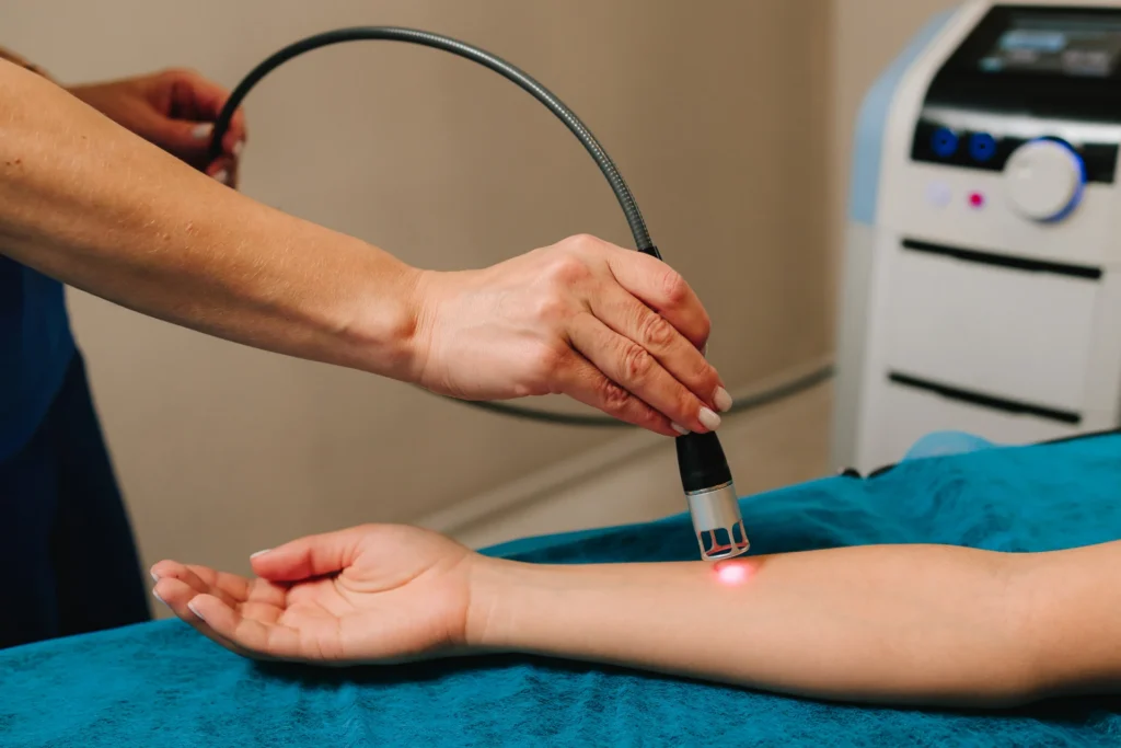 receiving laser therapy on arm in medical setting 2026 04 04 23 51 29 utc